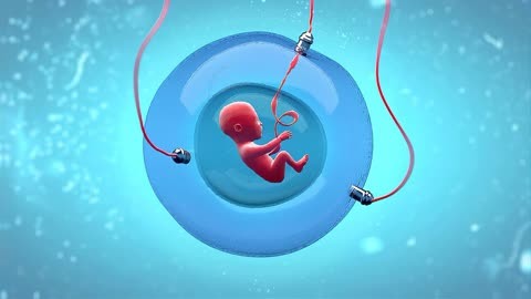 液氮存储